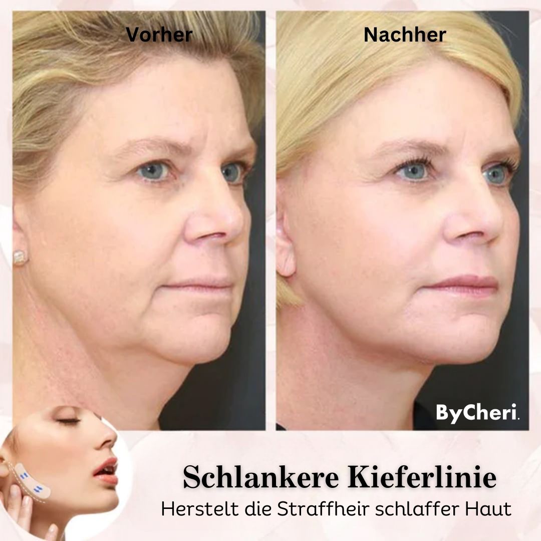 Ensemble de bandes adhésives pour le visage