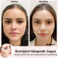 Ensemble de bandes adhésives pour le visage