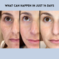 Patchs de soin pour visage, yeux ou front