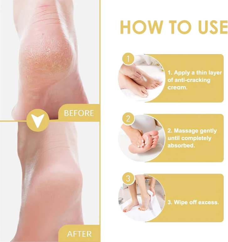 Lot de 3 crèmes pour les talons