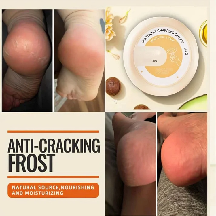 Lot de 3 crèmes pour les talons