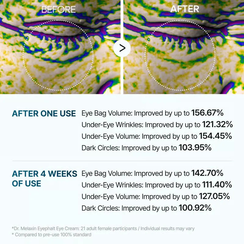 Lot de 2 crèmes contour des yeux à la niacinamide