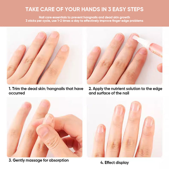 Huile de soin des ongles et cuticules à la vitamine E