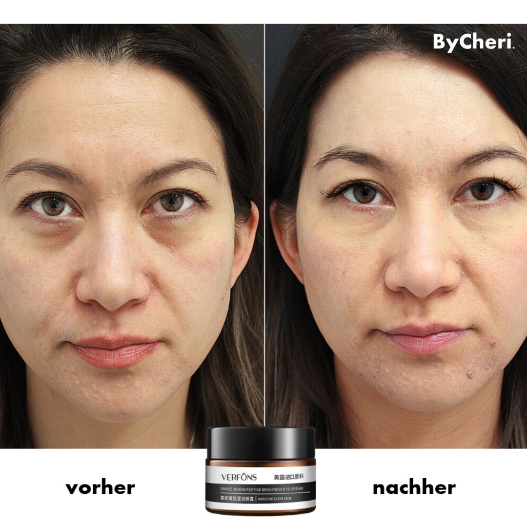 Crème pour le contour des yeux à la niacinamide, 30 g