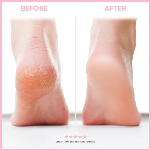 Râpe manuelle pour les pieds