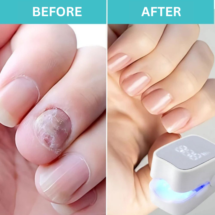 Appareil de soin des ongles