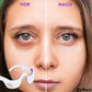 Appareil de massage à microcourants pour le contour des yeux