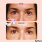 Appareil de massage à microcourants pour le contour des yeux