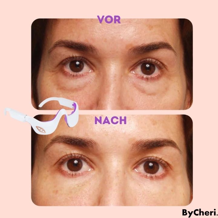 Appareil de massage à microcourants pour le contour des yeux