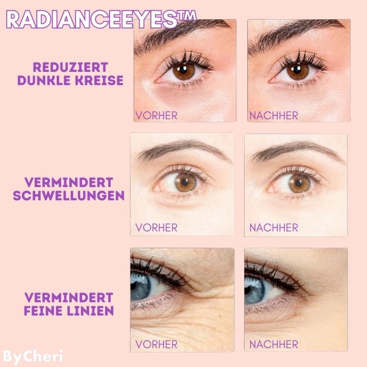 Appareil de massage à microcourants pour le contour des yeux