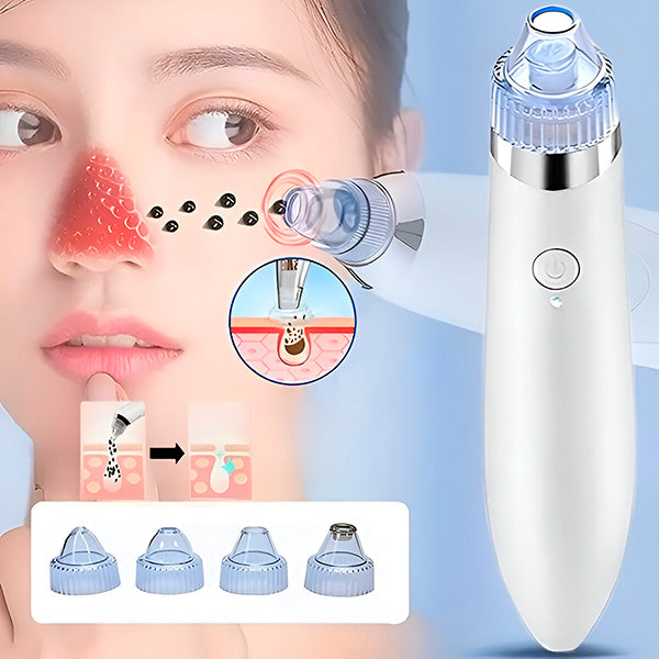 Nettoyeur de pores et appareil de microdermabrasion rechargeable USB