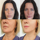 Patchs réutilisables pour visage et cou – 11 ou 16 pièces