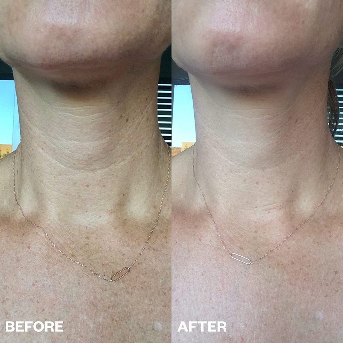 Patchs réutilisables pour visage et cou – 11 ou 16 pièces