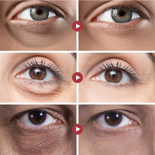 Crème contour des yeux à l’acide hyaluronique, 20 ml