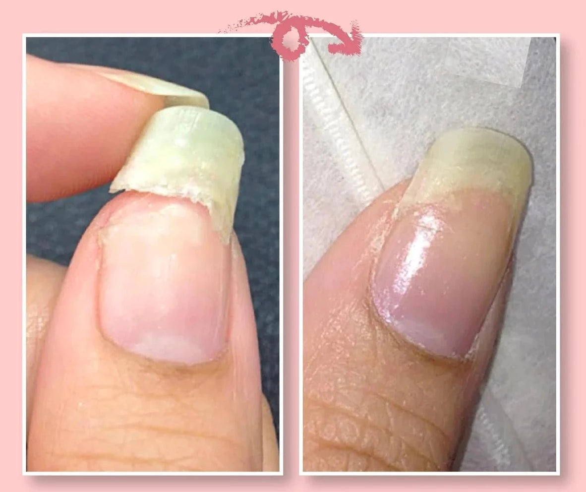 Gel transparent de renforcement des ongles, 5 ml