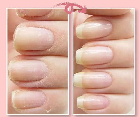 Gel transparent de renforcement des ongles, 5 ml