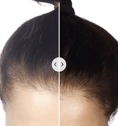 Brosse de massage du cuir chevelu avec brumisation et lumières