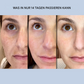 Bandes en gel pour le visage