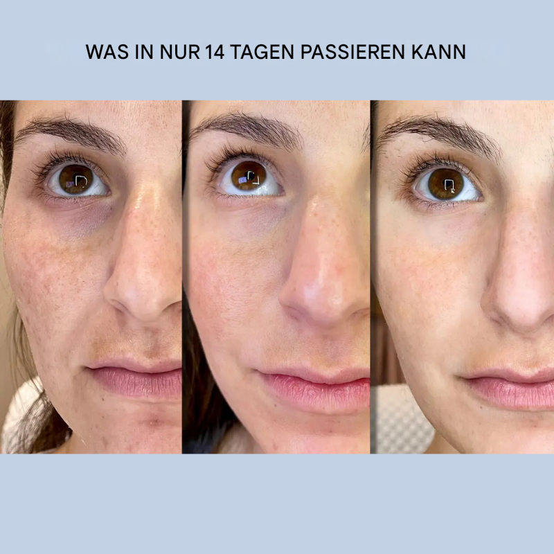 Bandes en gel pour le visage