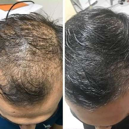 Shampoing solide à l’eau de riz fermentée, parfum musc-vanille
