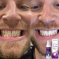 Dentifrice coloré pour l’hygiène buccale