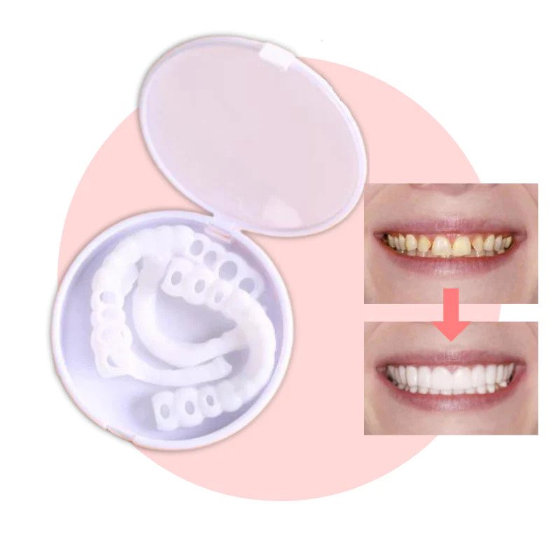 Facettes dentaires amovibles cosmétiques