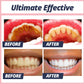 Dentifrice blancheur pour taches de surface