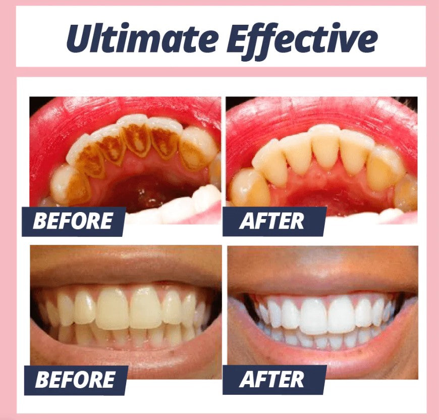 Dentifrice blancheur pour taches de surface