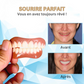 Facettes dentaires cosmétiques amovibles avec bandes de moulage
