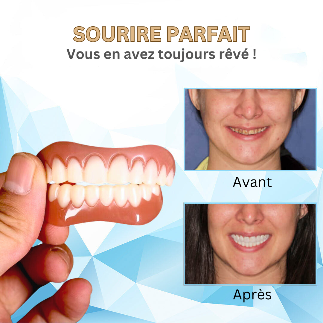 Facettes dentaires cosmétiques amovibles avec bandes de moulage